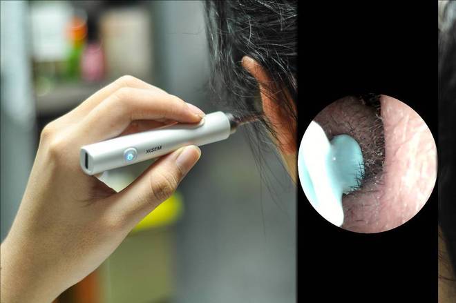 挖耳勺到底怎么选？十大品牌测评分享！MG不朽情缘带摄像头的挖耳勺好用吗？(图9)